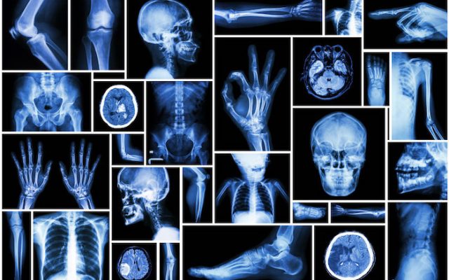 Radiologie : quand la logique comptable oublie la médecine